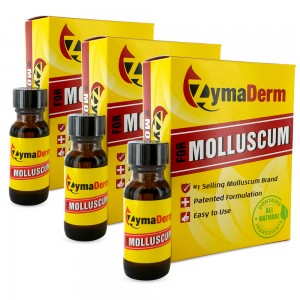ZymaDerm Molluscum - Solution Topique contre le Molluscum Contagiosum - Ingredients Naturels - 3